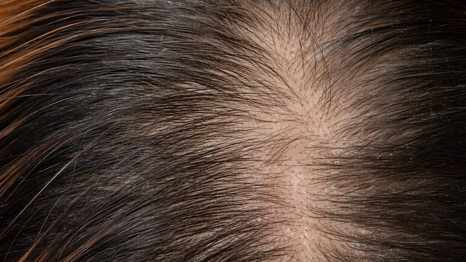 Biotin Saç Dökülmesine İyi Gelir mi?