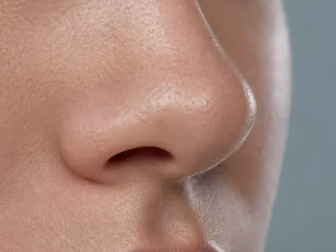 Burun Ucu Estetiği (Tip Plasti): Sadece Ucu Düzeltmek Mümkün mü?