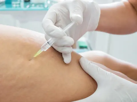 Selülit ve Lipoliz Mezoterapisi: Bölgesel Görünüm Tedavisi — uygulama görseli